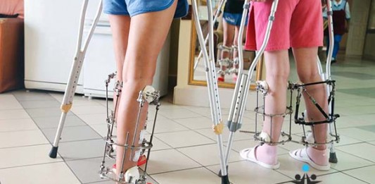 Phẫu thuật tăng chiều cao và những hiểm nguy khôn lường